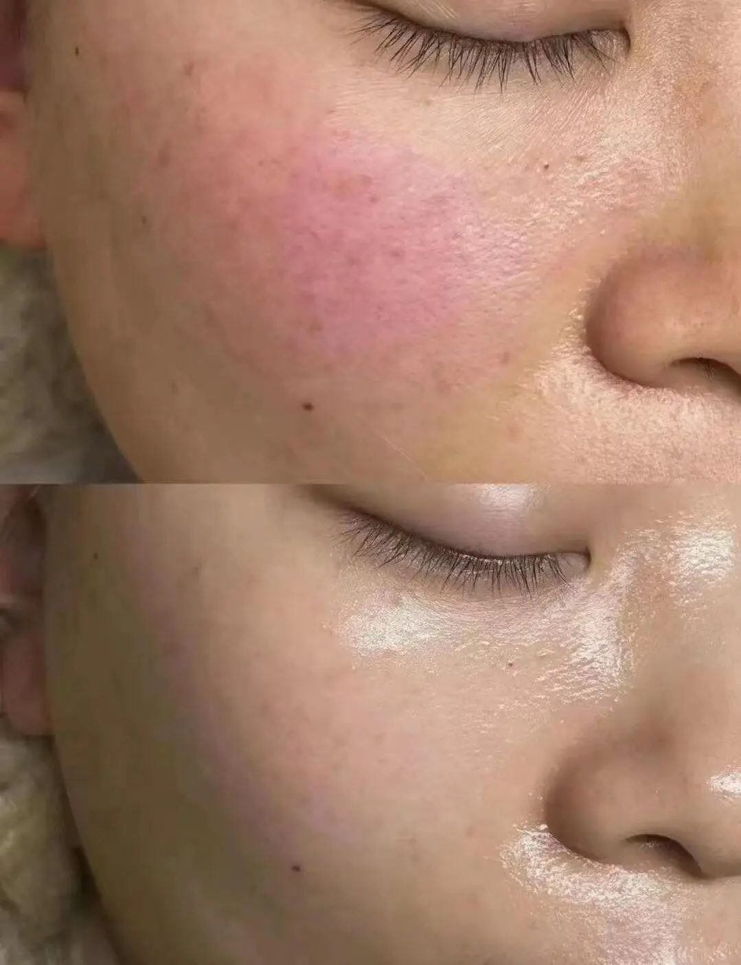 LDM before and after