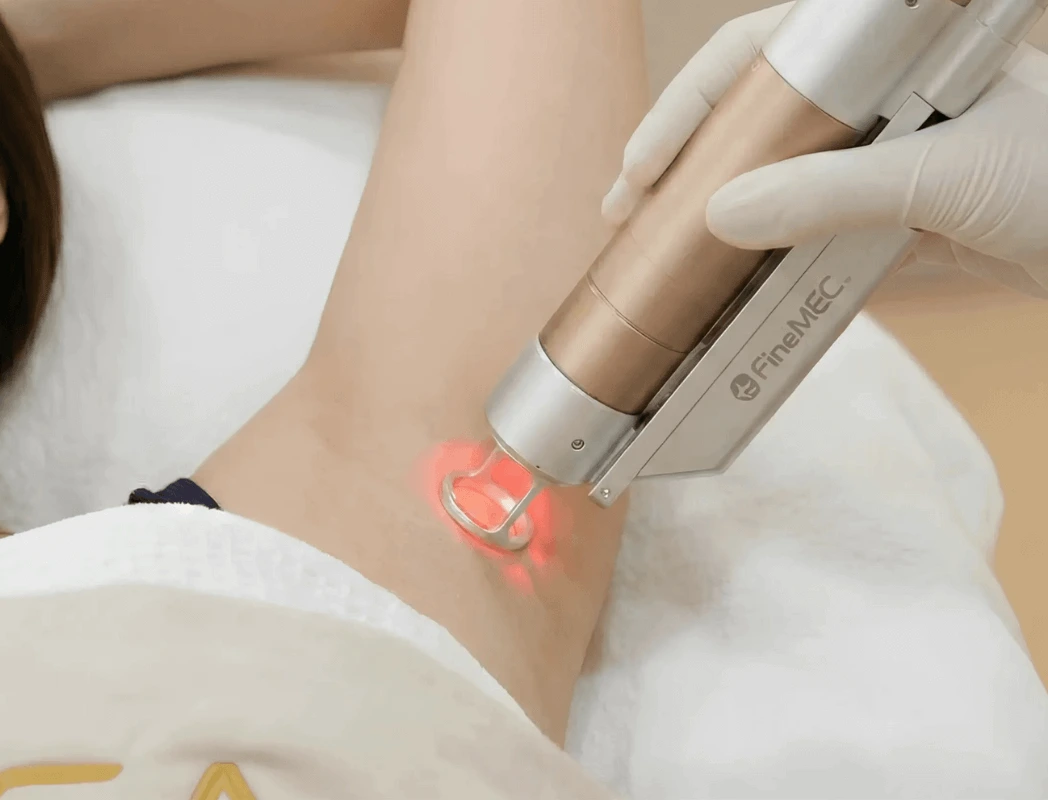 Laser hair removal in Bangkok at Edition Clinic Thonglor using Alexandrite and Nd:YAG technology