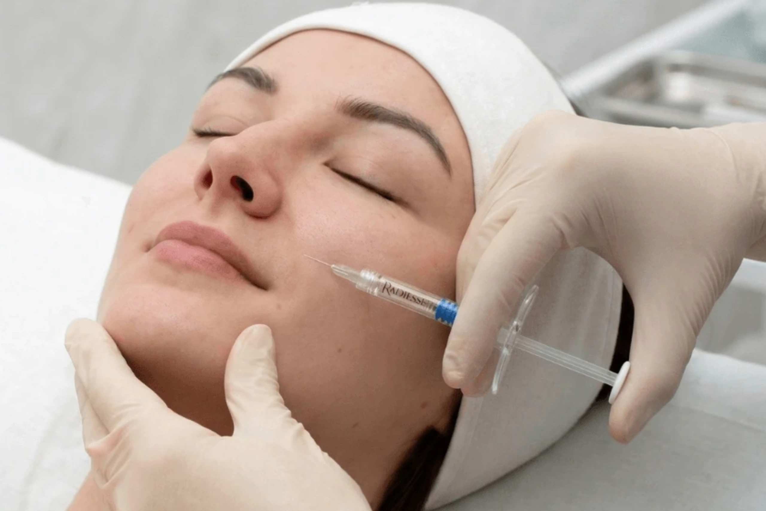 Radiesse calcium hydroxylapatite filler treatment