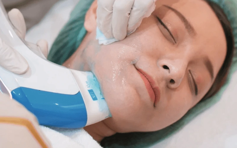 Ultraformer MPT treatment areas for face and body at Edition Clinic Bangkok