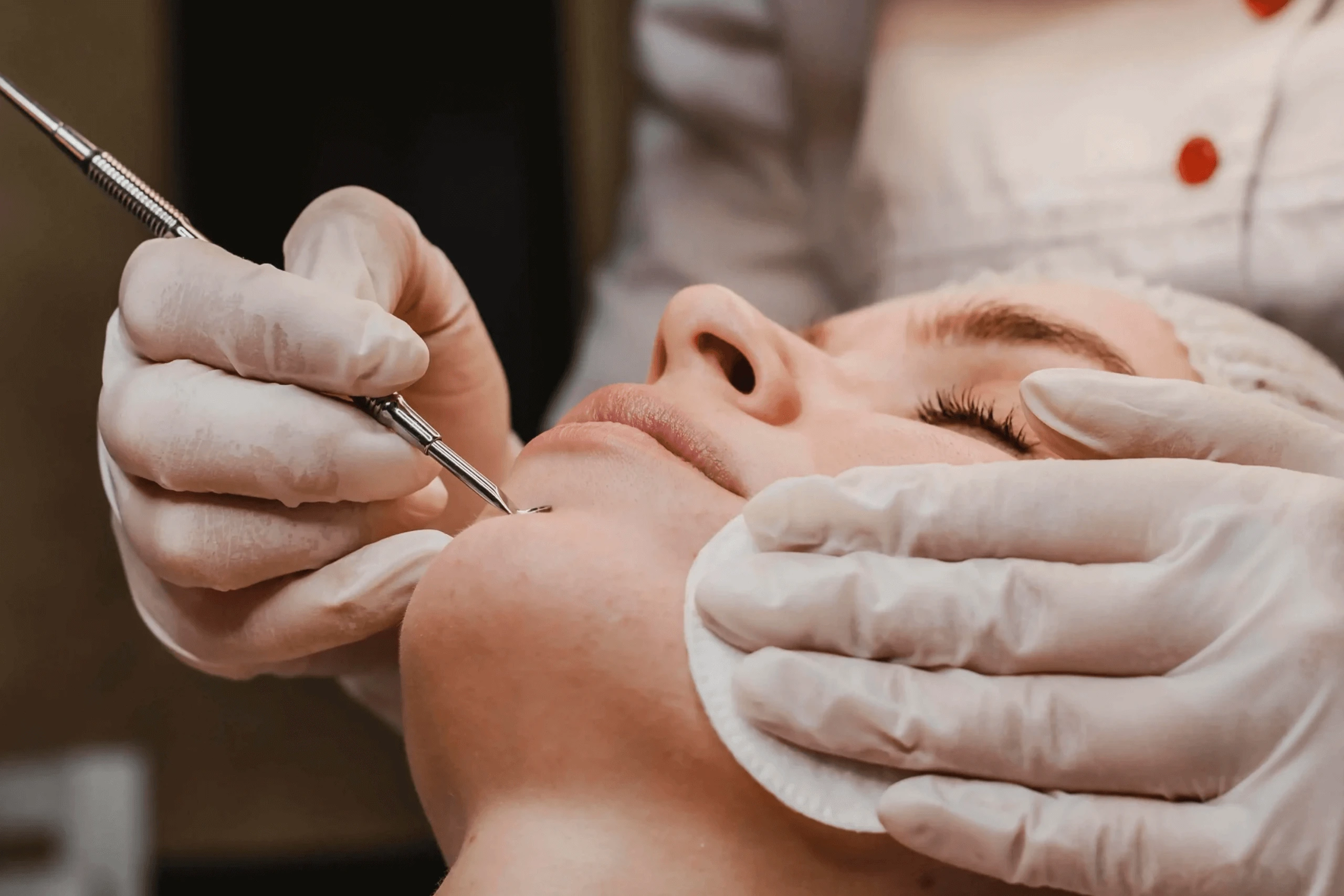 Acne Treatment and breakout prevention