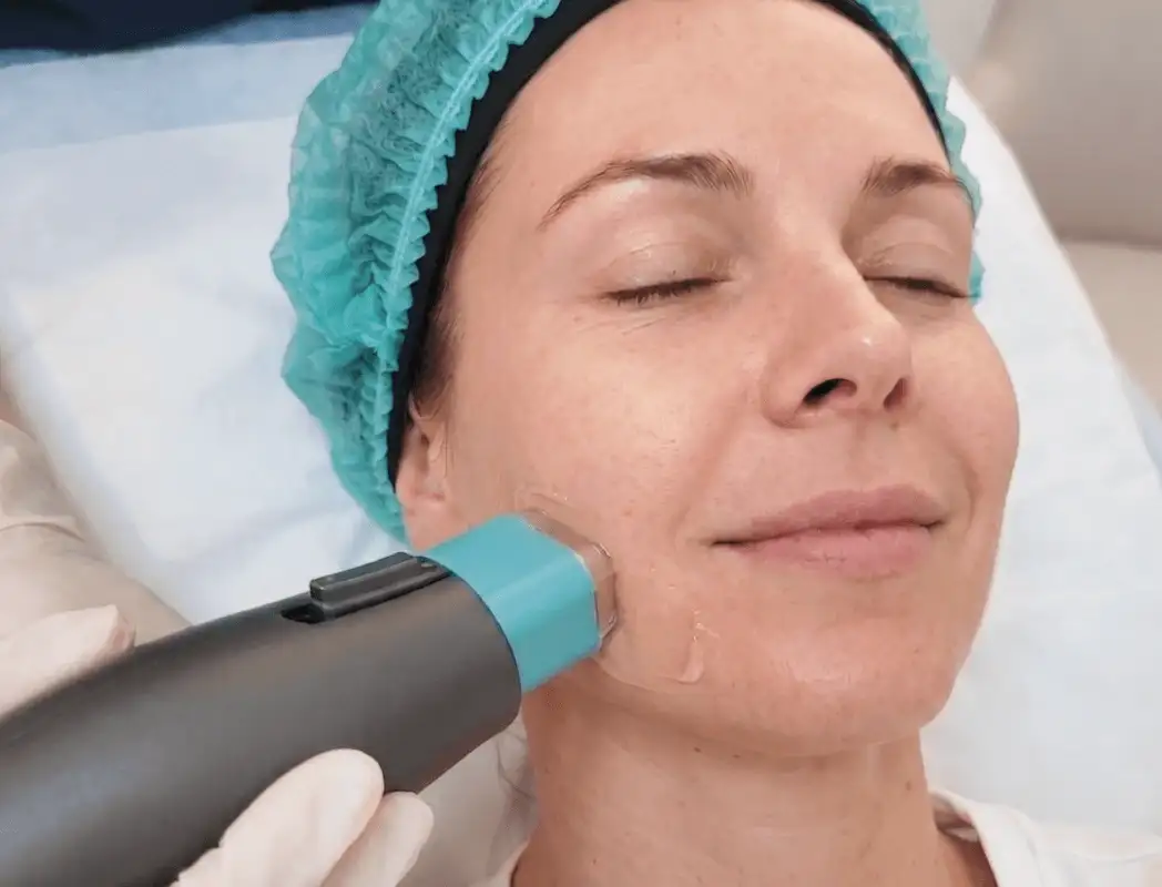 Oligio X monopolar RF handpiece treatment delivering energy to dermis layer at Edition Clinic Bangkok