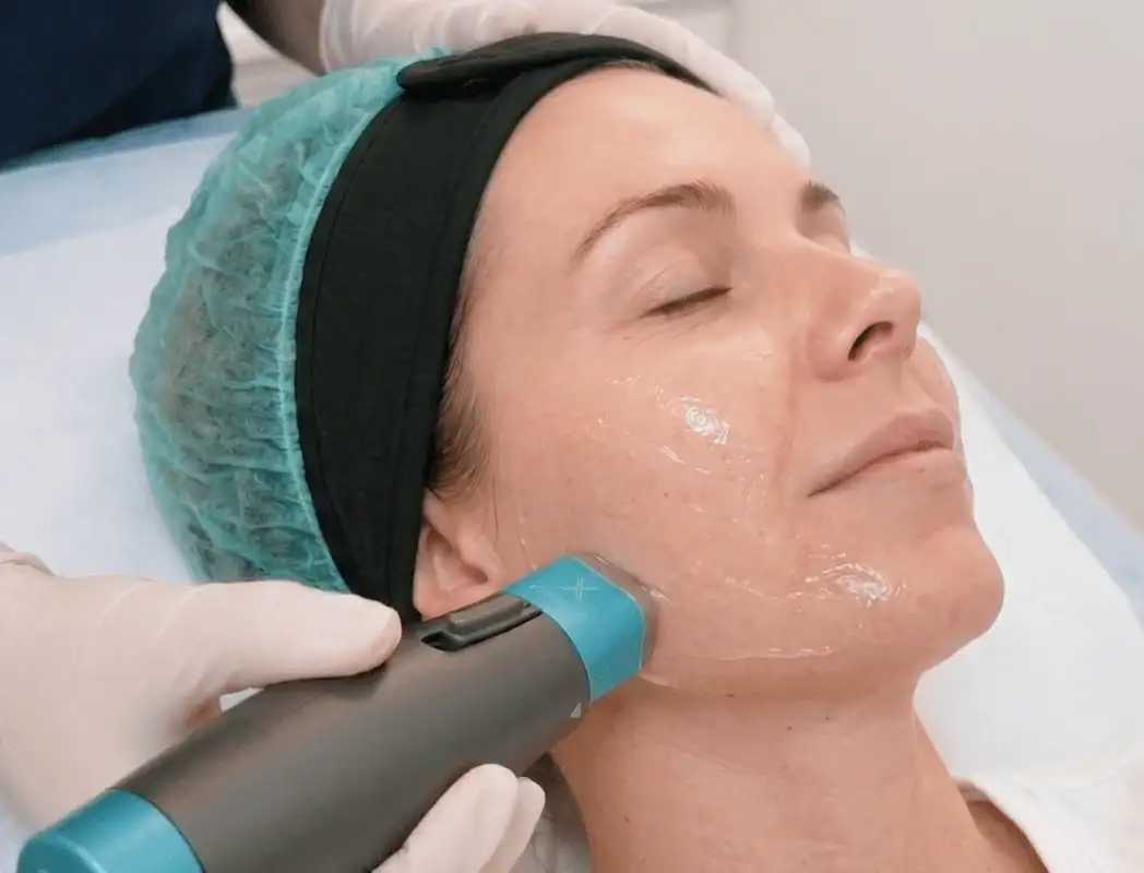 Oligio X RF treatment performed by a licensed doctor at Edition Clinic Bangkok